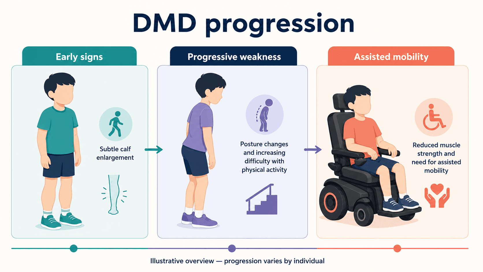 Illustrative overview of DMD progression from early signs to assisted mobility